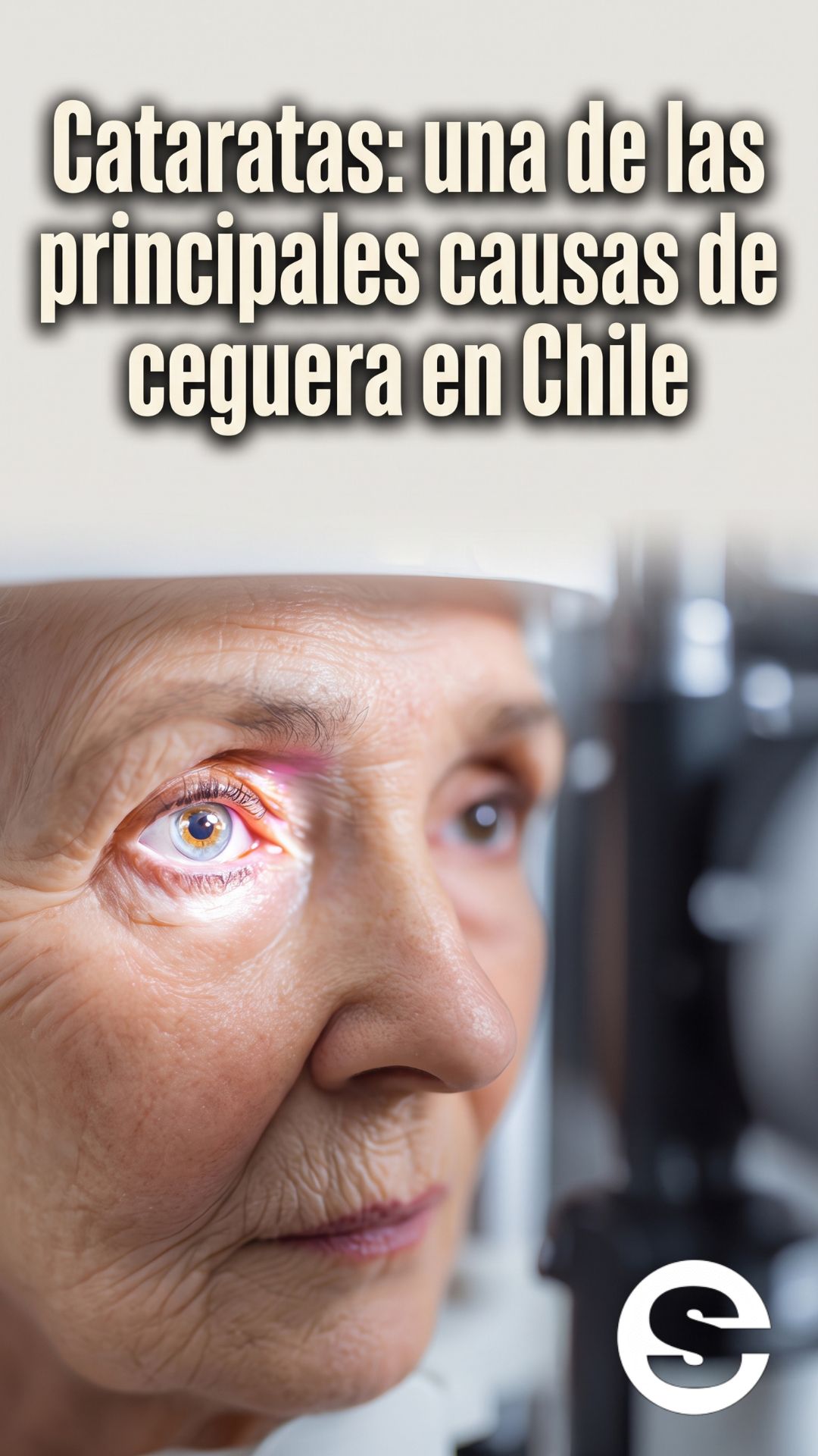 🇨🇱🧘 Cataratas: una de las principales causas de ceguera en Chile 🩺.