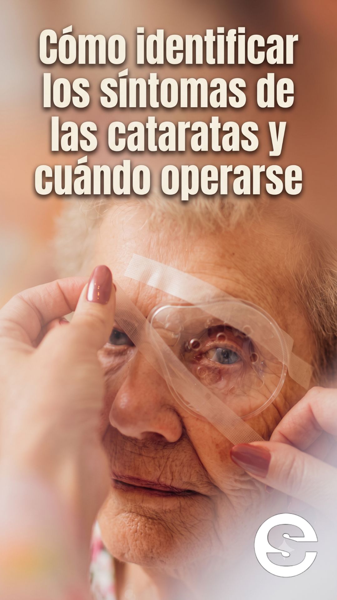🇨🇱🧘 Principal causa de ceguera en chile: Como identificar los sintomas de las cataratas y cuando operarse 🩺.